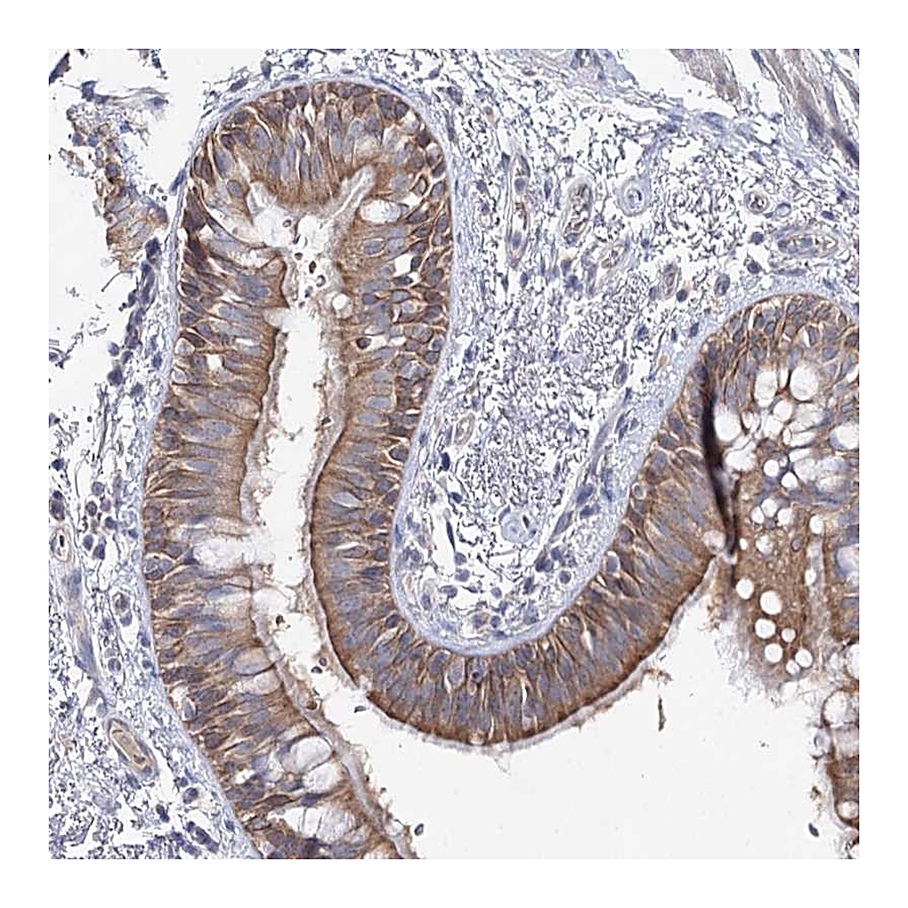 Atlas Antibodies Anti-LRRC14B Antibody