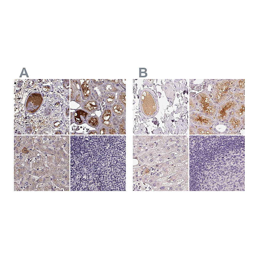 Atlas Antibodies Anti-AFM Antibody