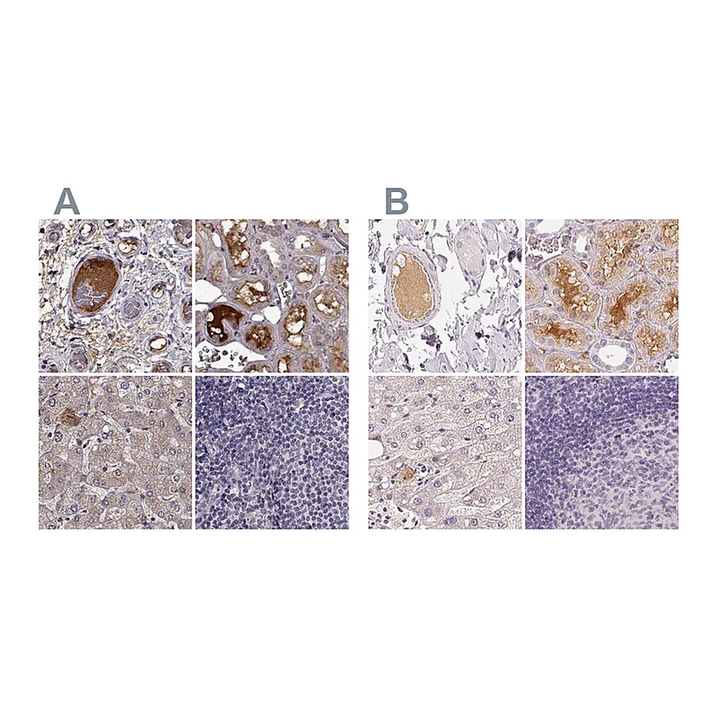 Atlas Antibodies Anti-AFM Antibody