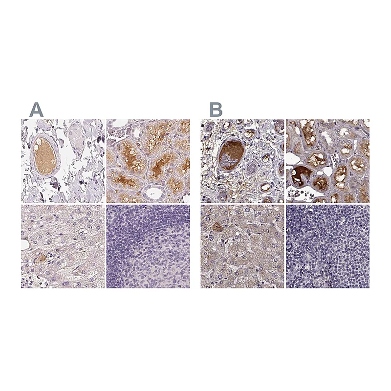 Atlas Antibodies Anti-AFM Antibody
