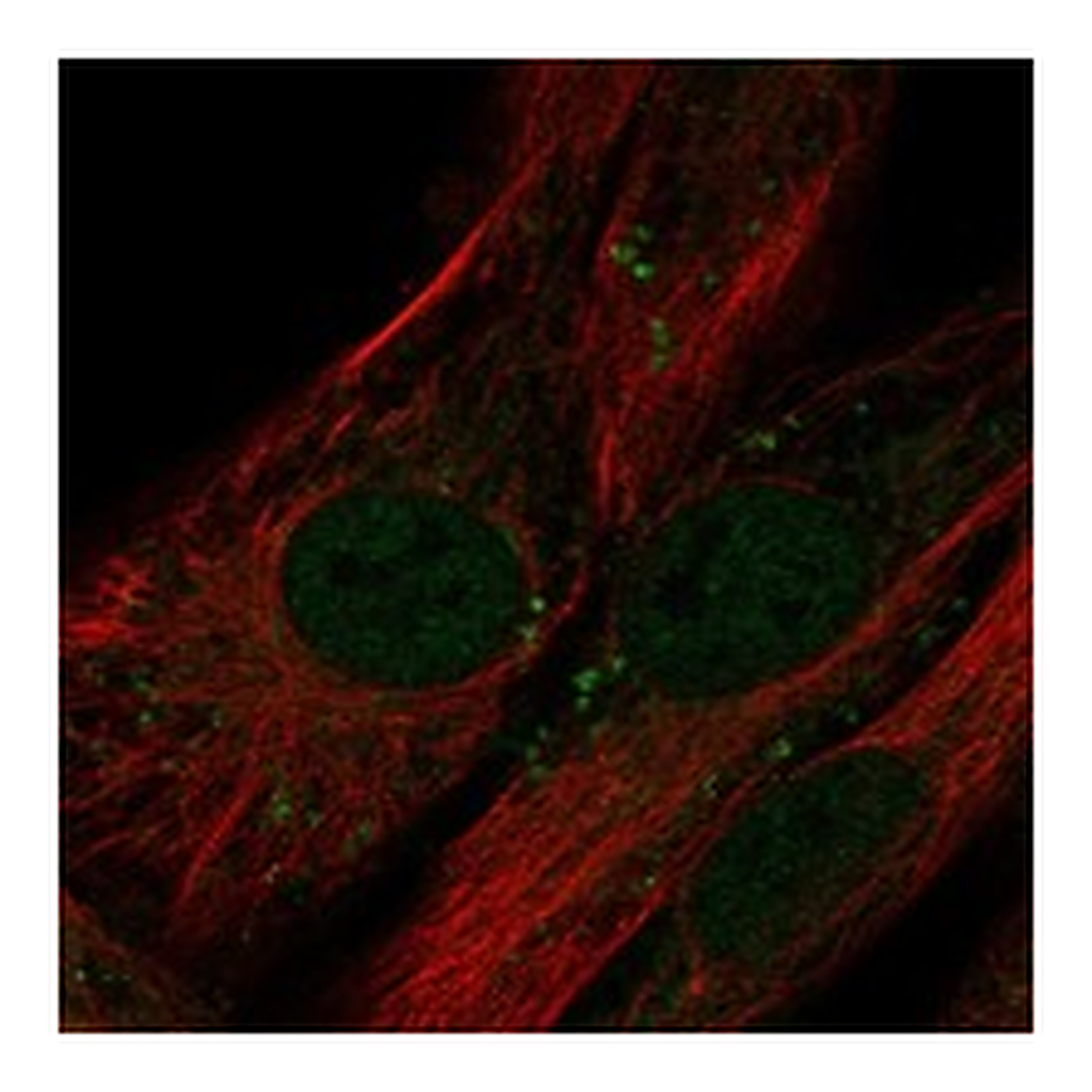 Atlas Antibodies Anti-LRRC17 Antibody
