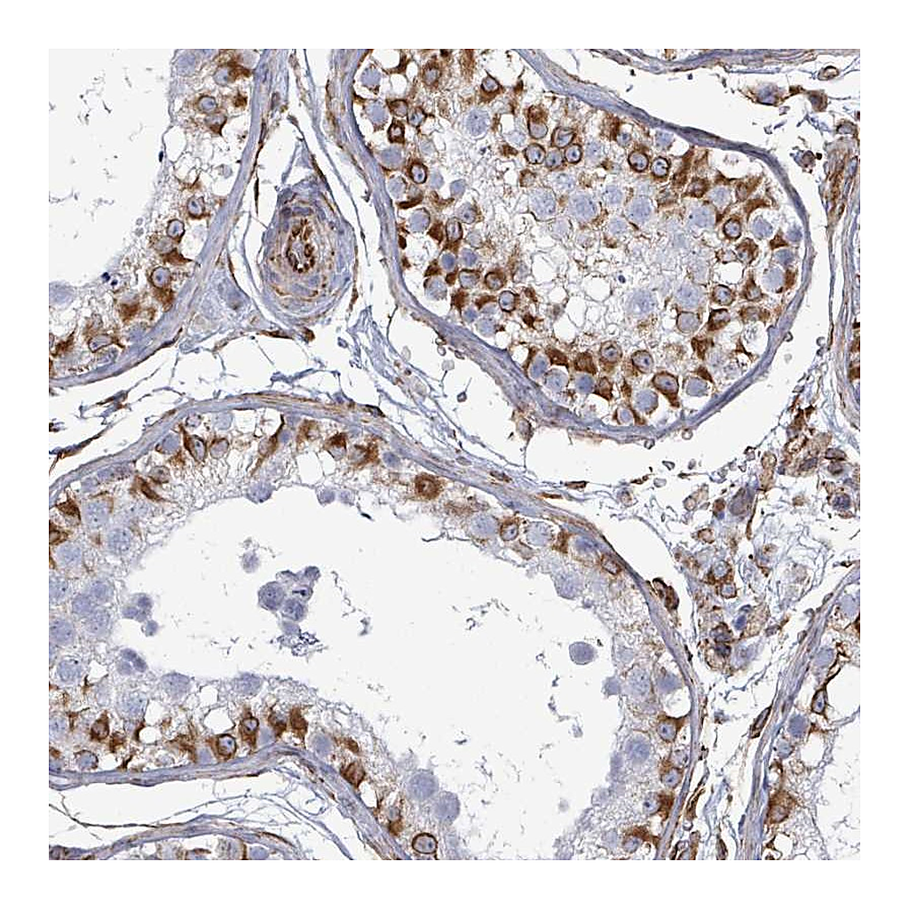 Atlas Antibodies Anti-AGAP1 Antibody