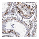 Atlas Antibodies Anti-AGAP1 Antibody