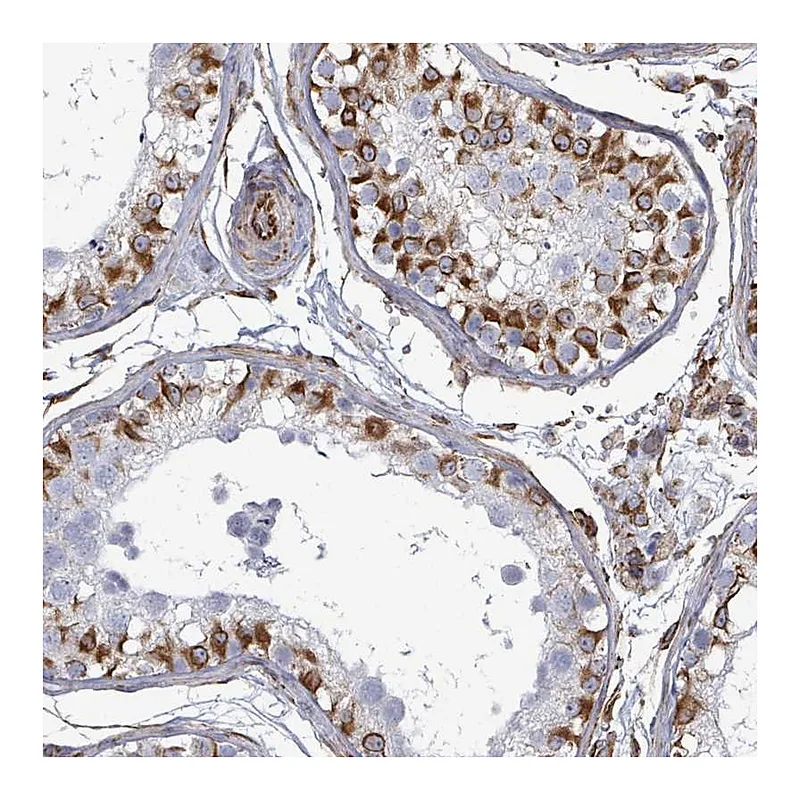 Atlas Antibodies Anti-AGAP1 Antibody