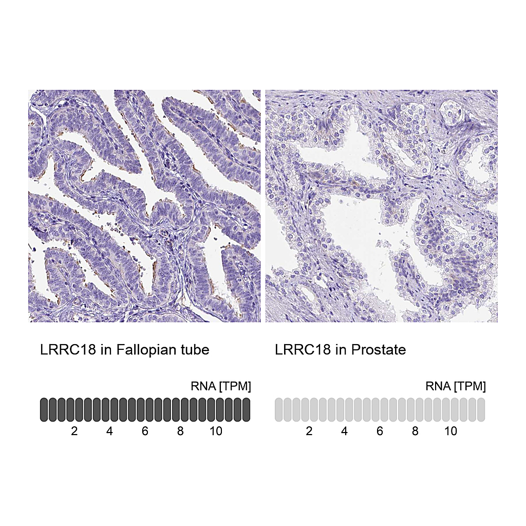 Atlas Antibodies Anti-LRRC18 Antibody