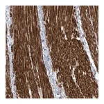 Atlas Antibodies Anti-AFTPH Antibody