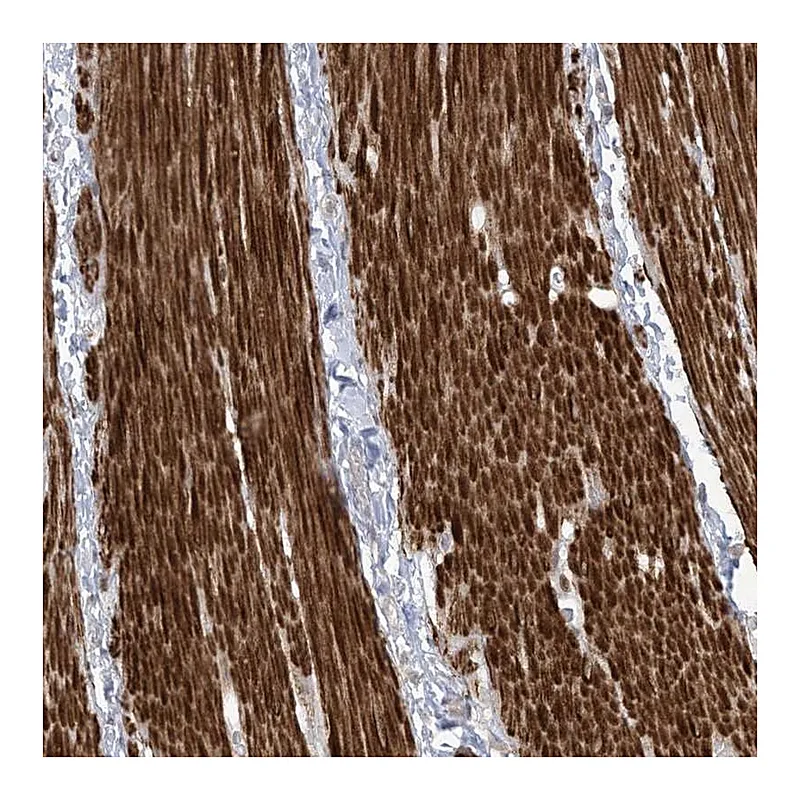 Atlas Antibodies Anti-AFTPH Antibody
