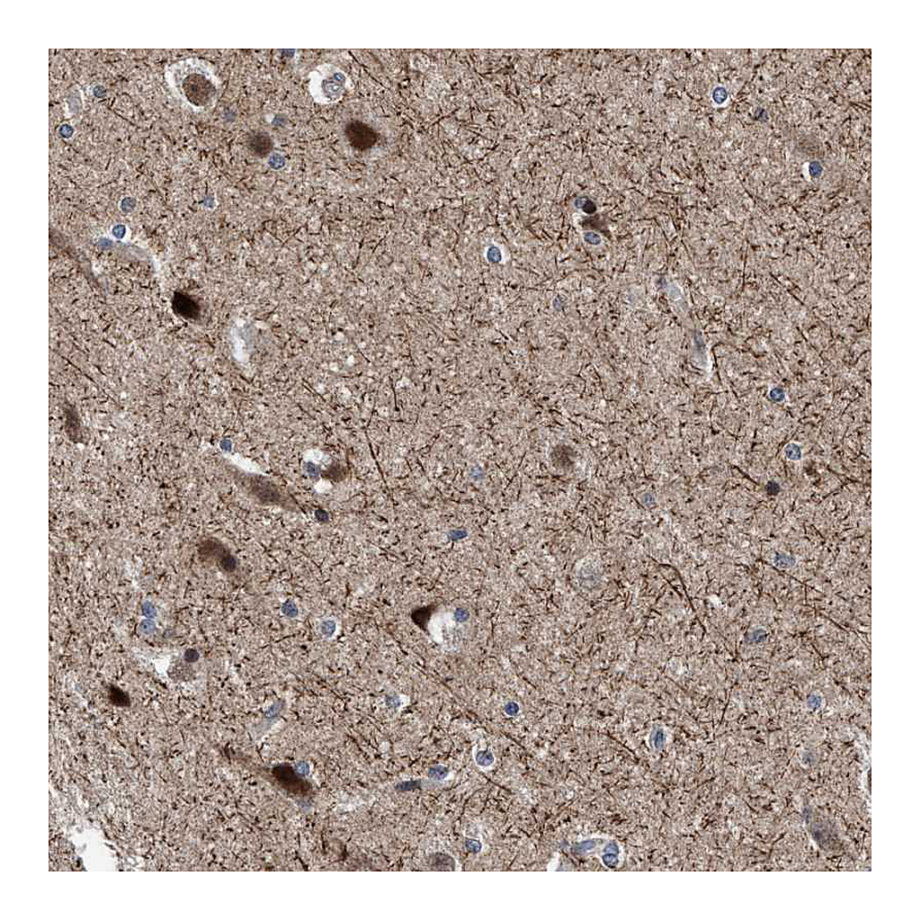 Atlas Antibodies Anti-AGAP2 Antibody
