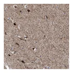 Atlas Antibodies Anti-AGAP2 Antibody
