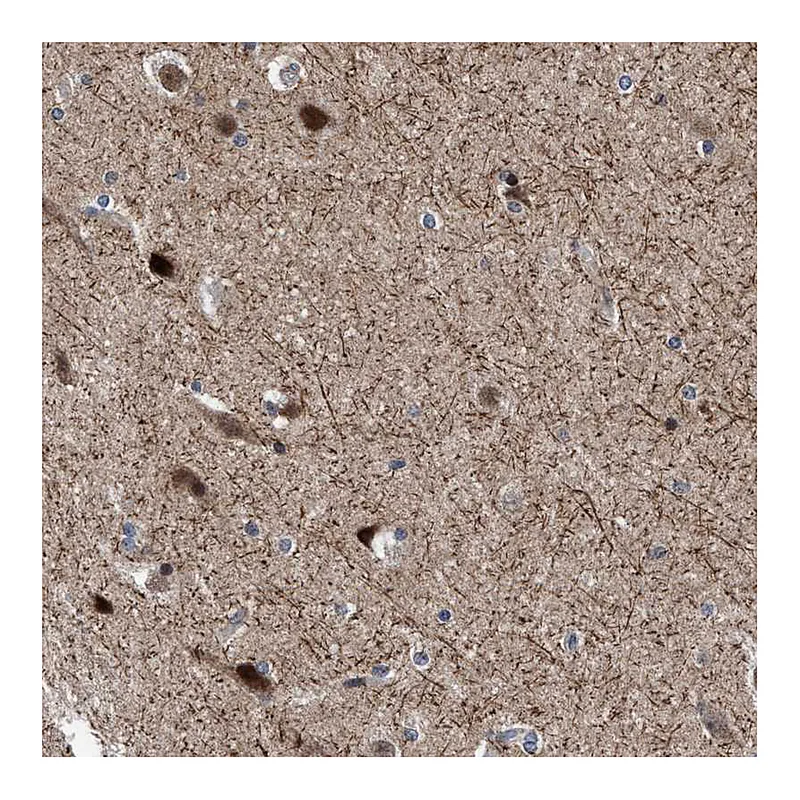 Atlas Antibodies Anti-AGAP2 Antibody