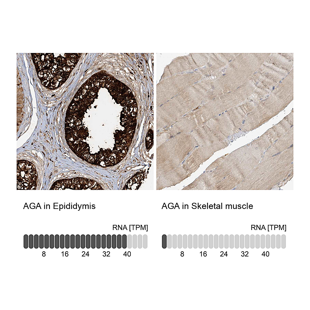 Atlas Antibodies Anti-AGA Antibody