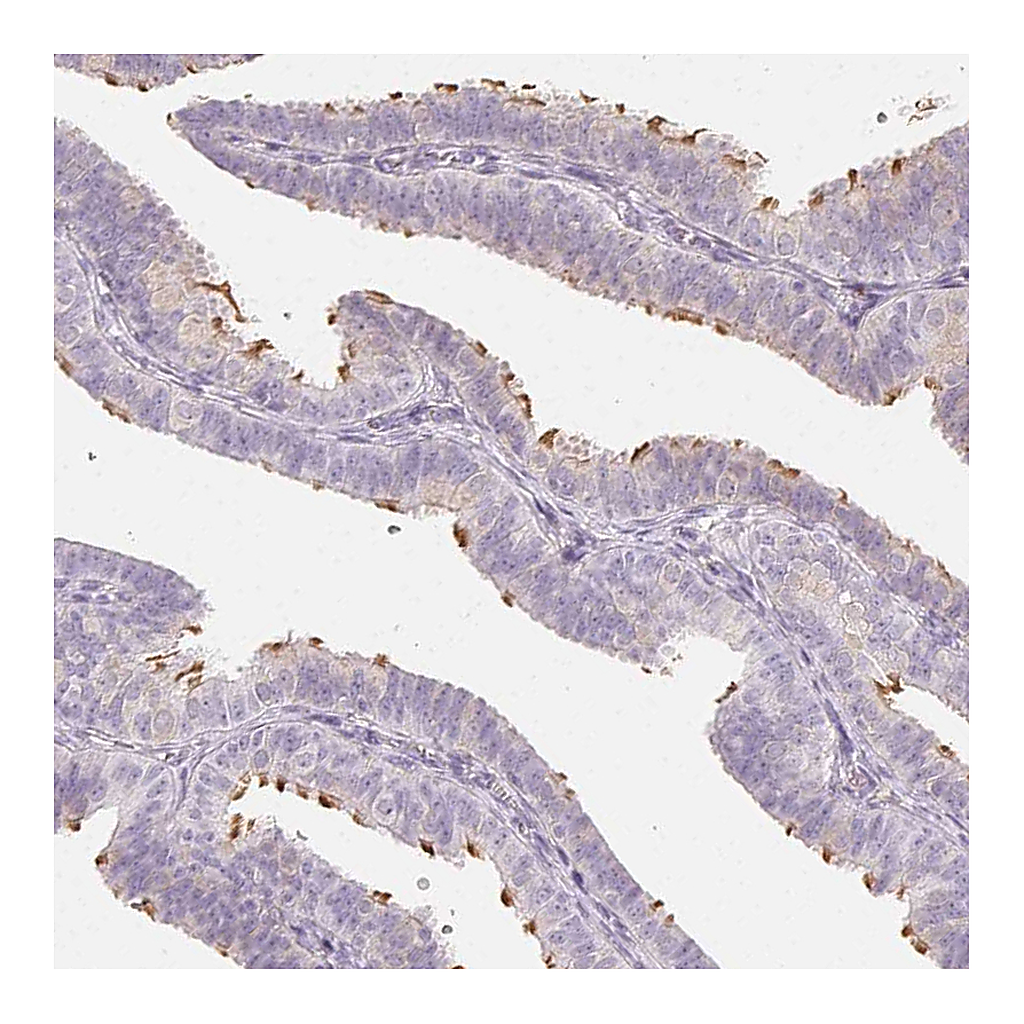 Atlas Antibodies Anti-LRRC23 Antibody