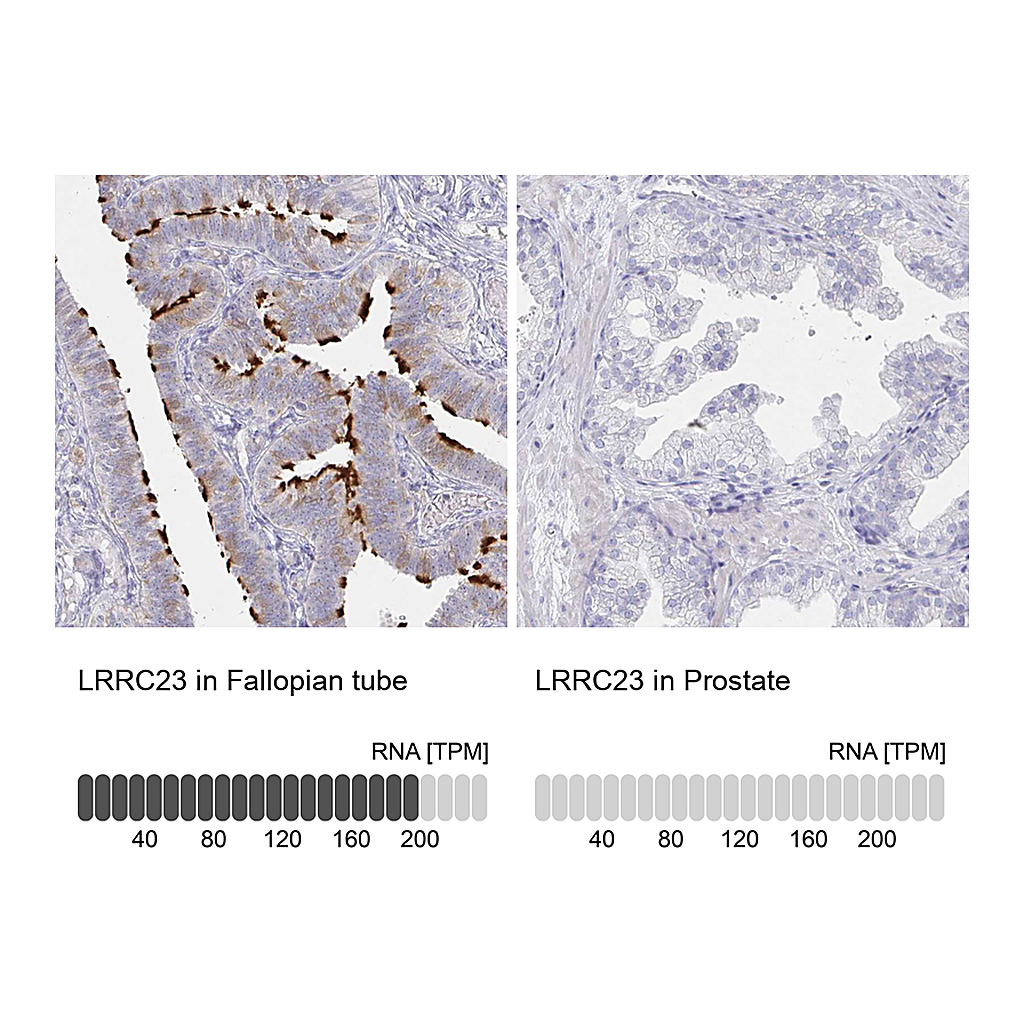 Atlas Antibodies Anti-LRRC23 Antibody