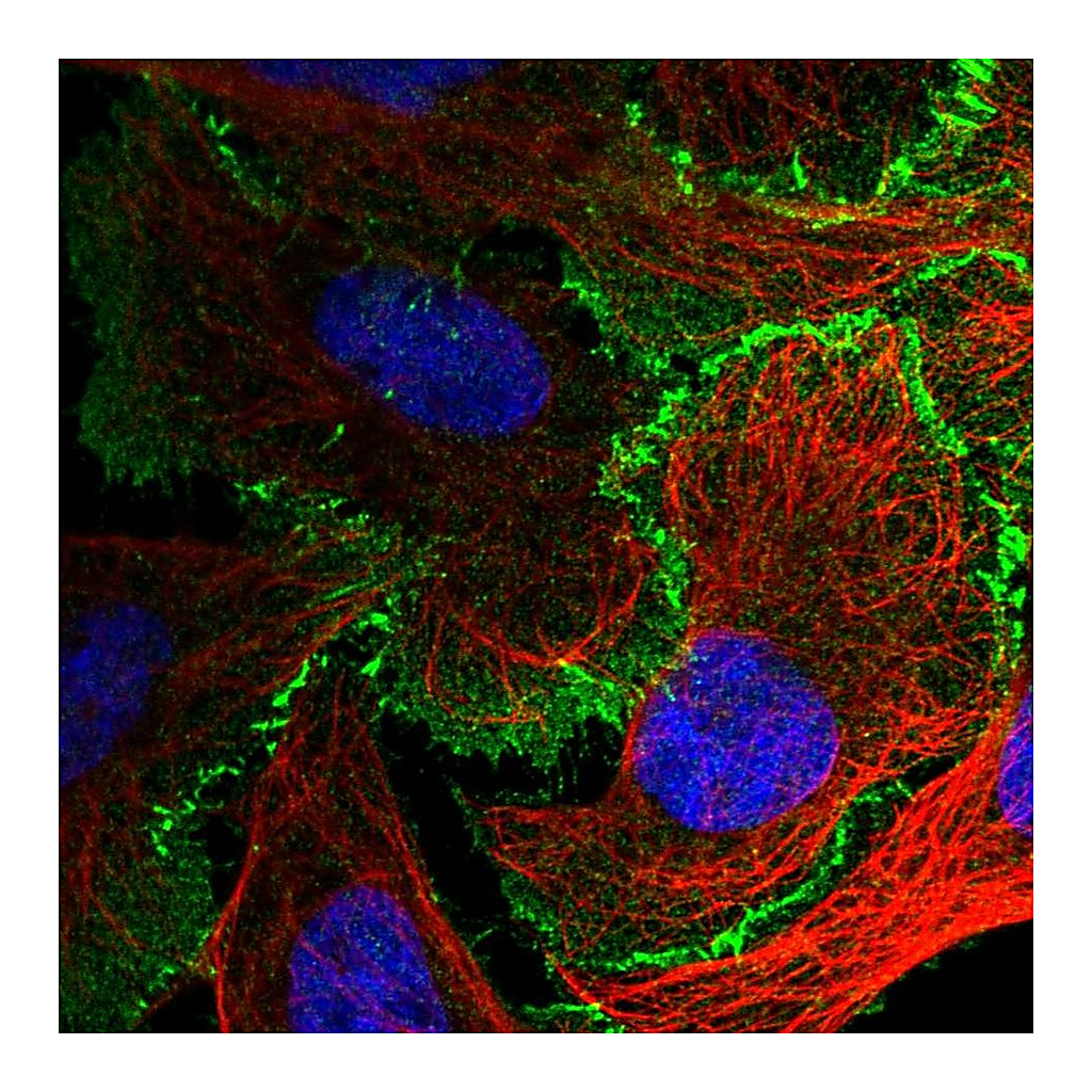 Atlas Antibodies Anti-AFDN Antibody