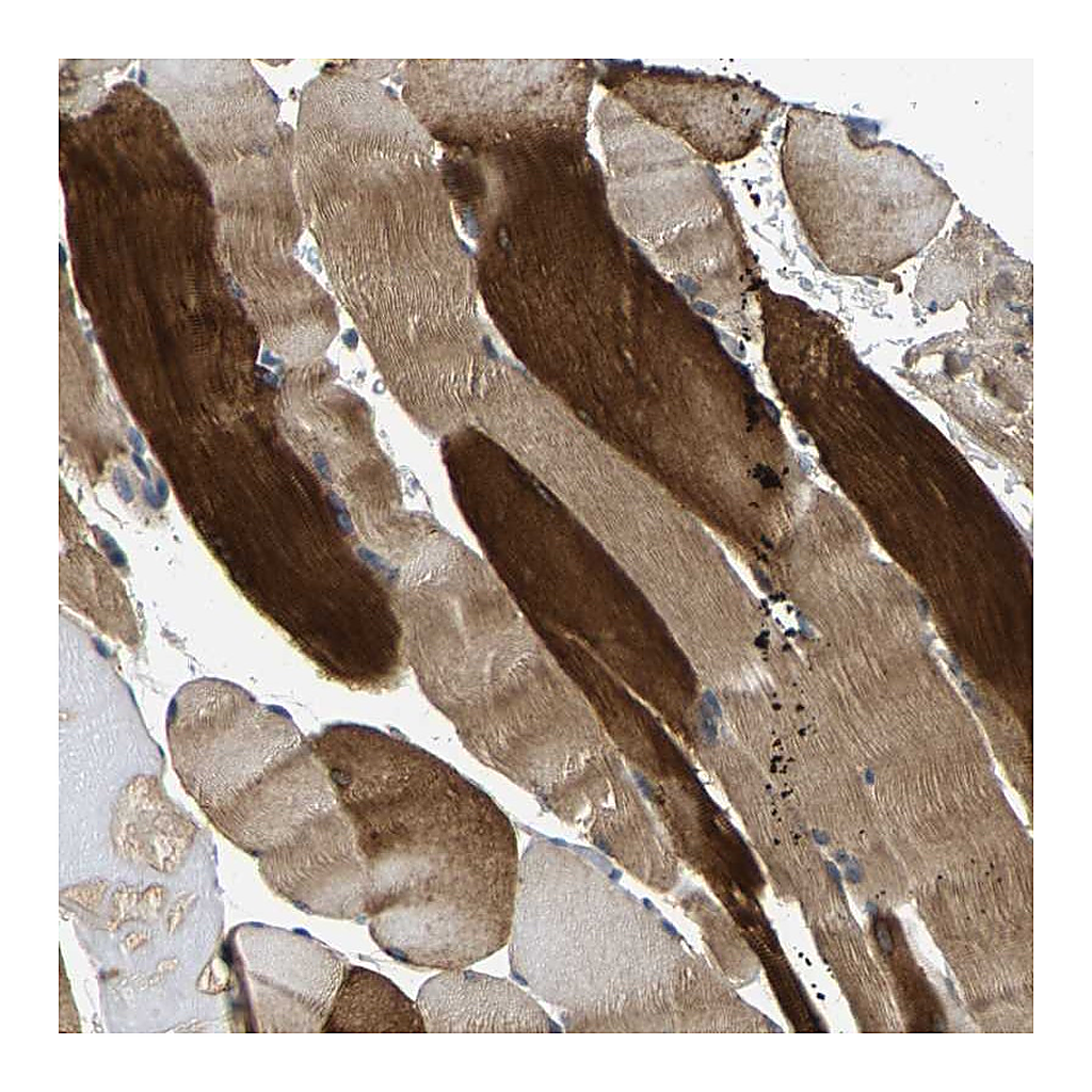 Atlas Antibodies Anti-AGBL3 Antibody