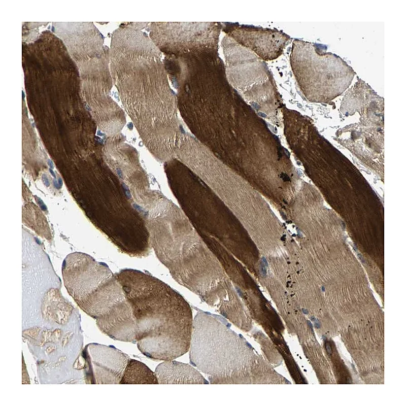 Atlas Antibodies Anti-AGBL3 Antibody