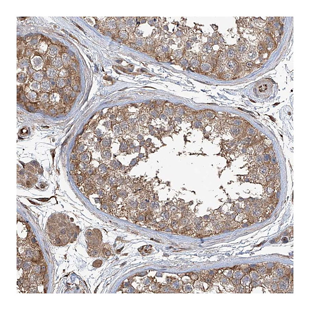 Atlas Antibodies Anti-AGBL5 Antibody