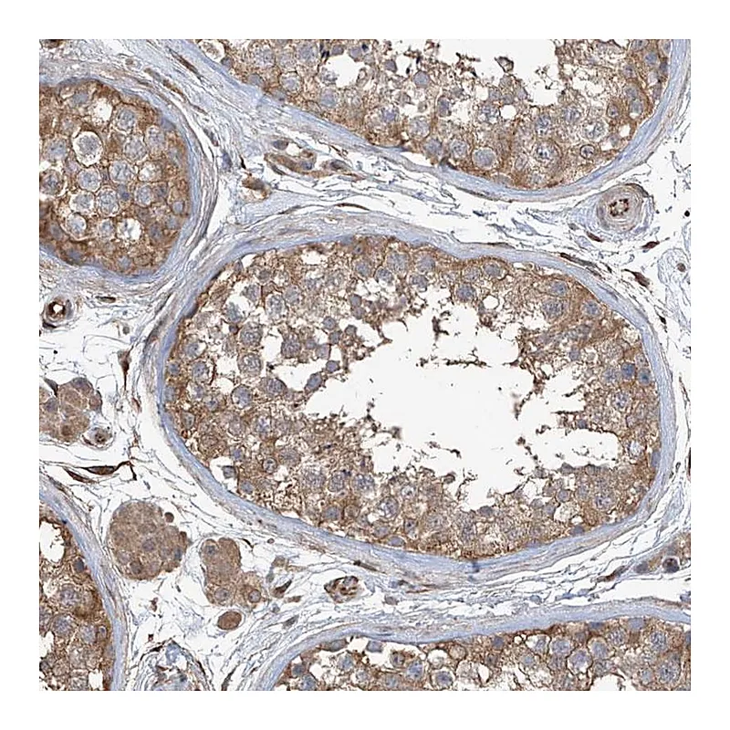 Atlas Antibodies Anti-AGBL5 Antibody