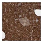 Atlas Antibodies Anti-AGBL3 Antibody