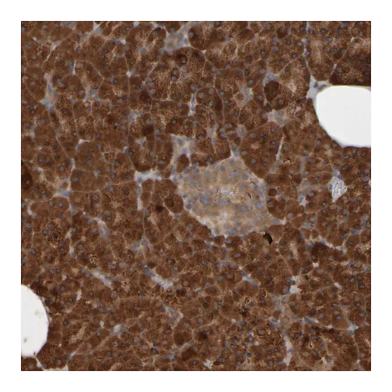 Atlas Antibodies Anti-AGBL3 Antibody