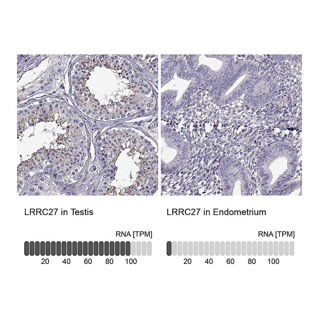 Atlas Antibodies Anti-LRRC27 Antibody