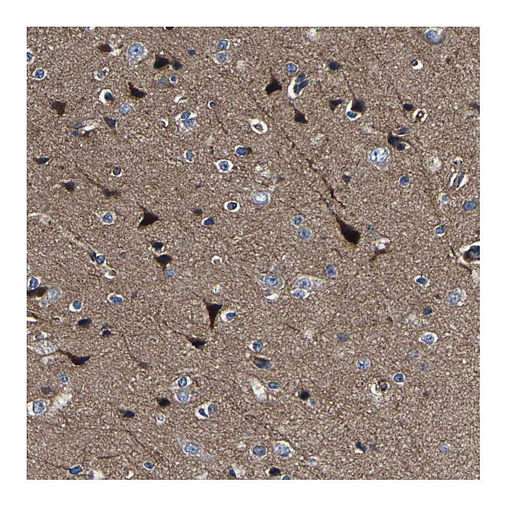 Atlas Antibodies Anti-AGAP3 Antibody