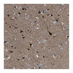 Atlas Antibodies Anti-AGAP3 Antibody
