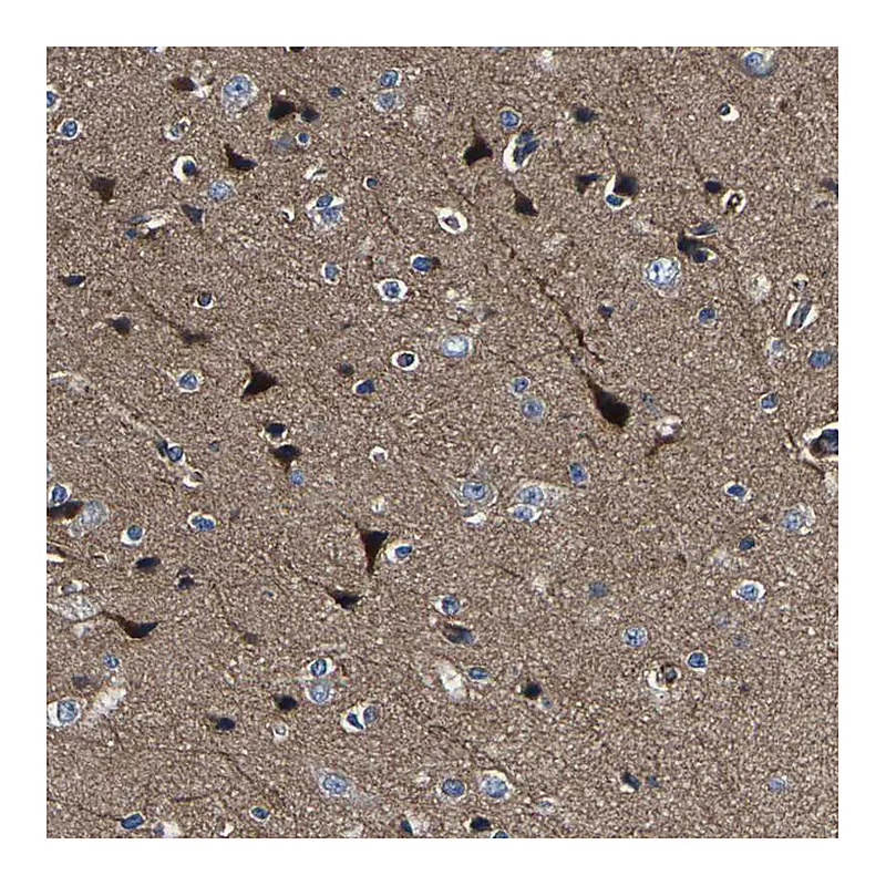 Atlas Antibodies Anti-AGAP3 Antibody