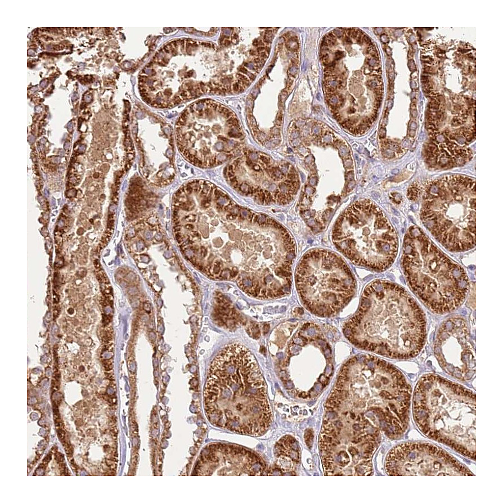 Atlas Antibodies Anti-LRRC28 Antibody