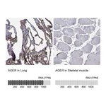 Atlas Antibodies Anti-AGER Antibody