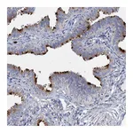 Atlas Antibodies Anti-AGBL4 Antibody