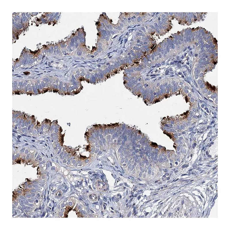 Atlas Antibodies Anti-AGBL4 Antibody