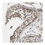 Atlas Antibodies Anti-AGBL2 Antibody