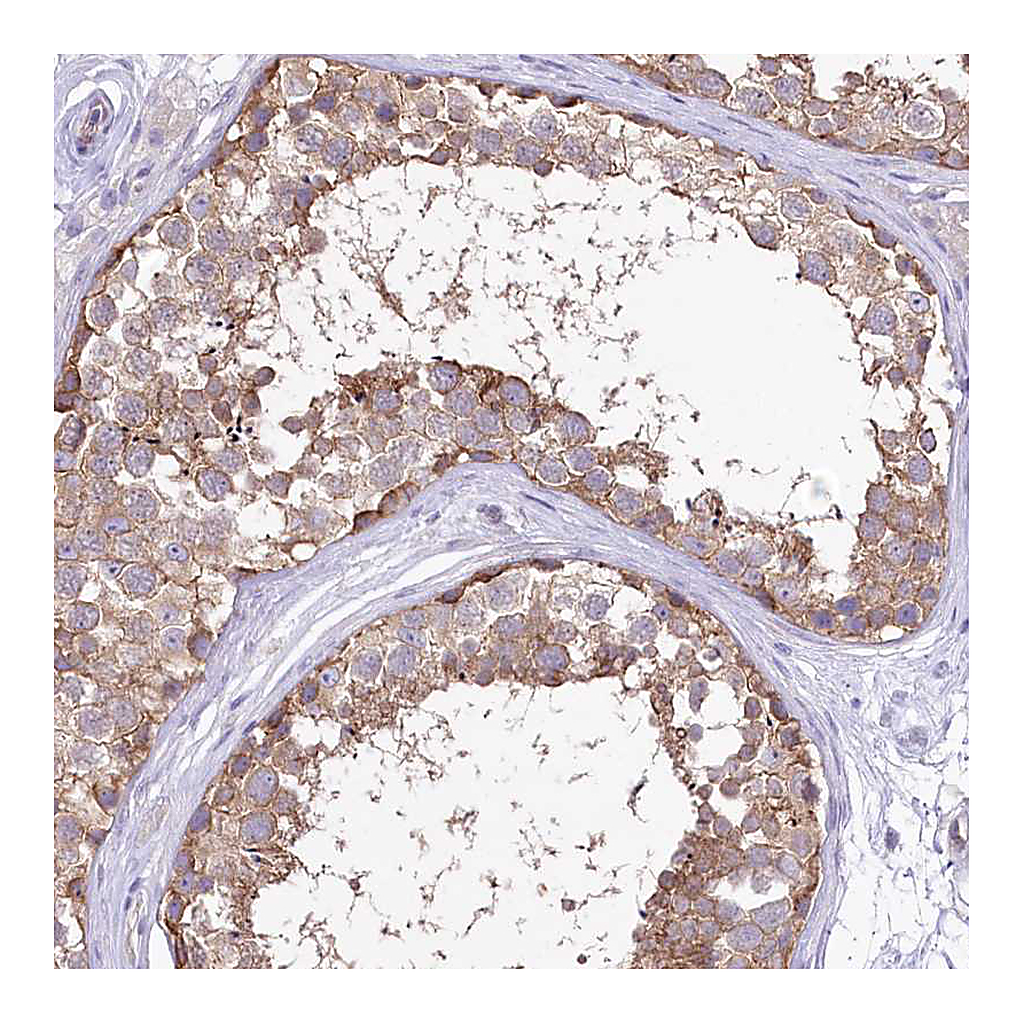 Atlas Antibodies Anti-LRRC34 Antibody