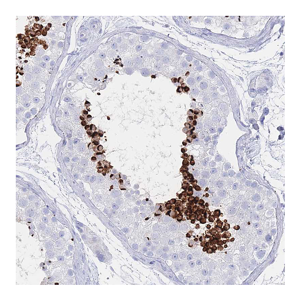 Atlas Antibodies Anti-LRRC37A Antibody