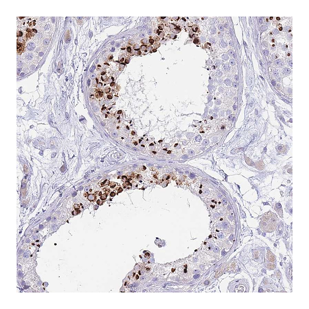 Atlas Antibodies Anti-LRRC37A2 Antibody