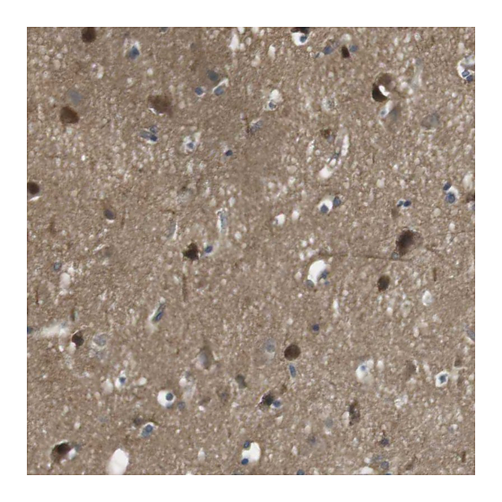 Atlas Antibodies Anti-LRRC3B Antibody