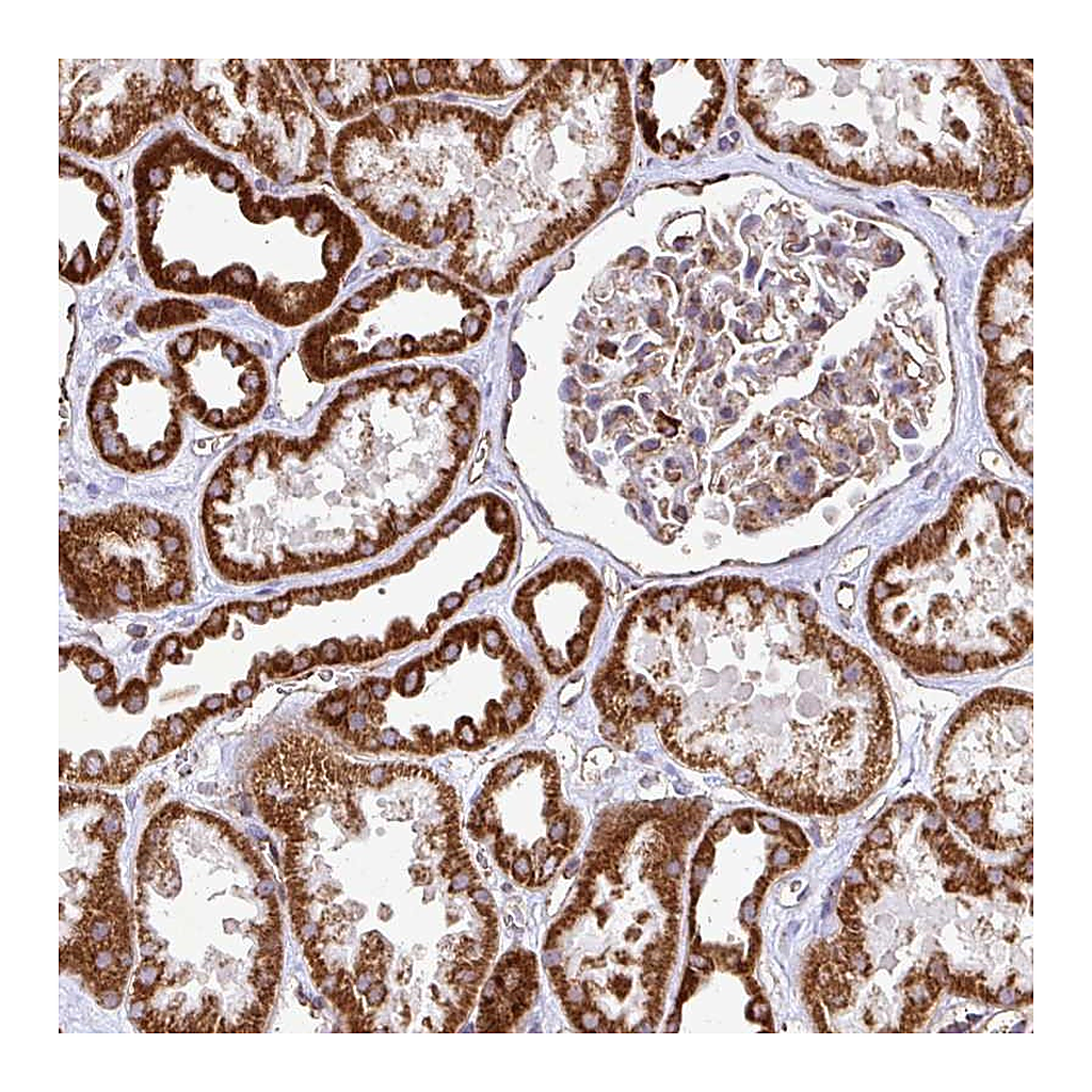 Atlas Antibodies Anti-AGK Antibody