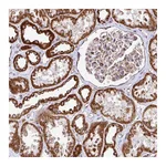 Atlas Antibodies Anti-AGK Antibody