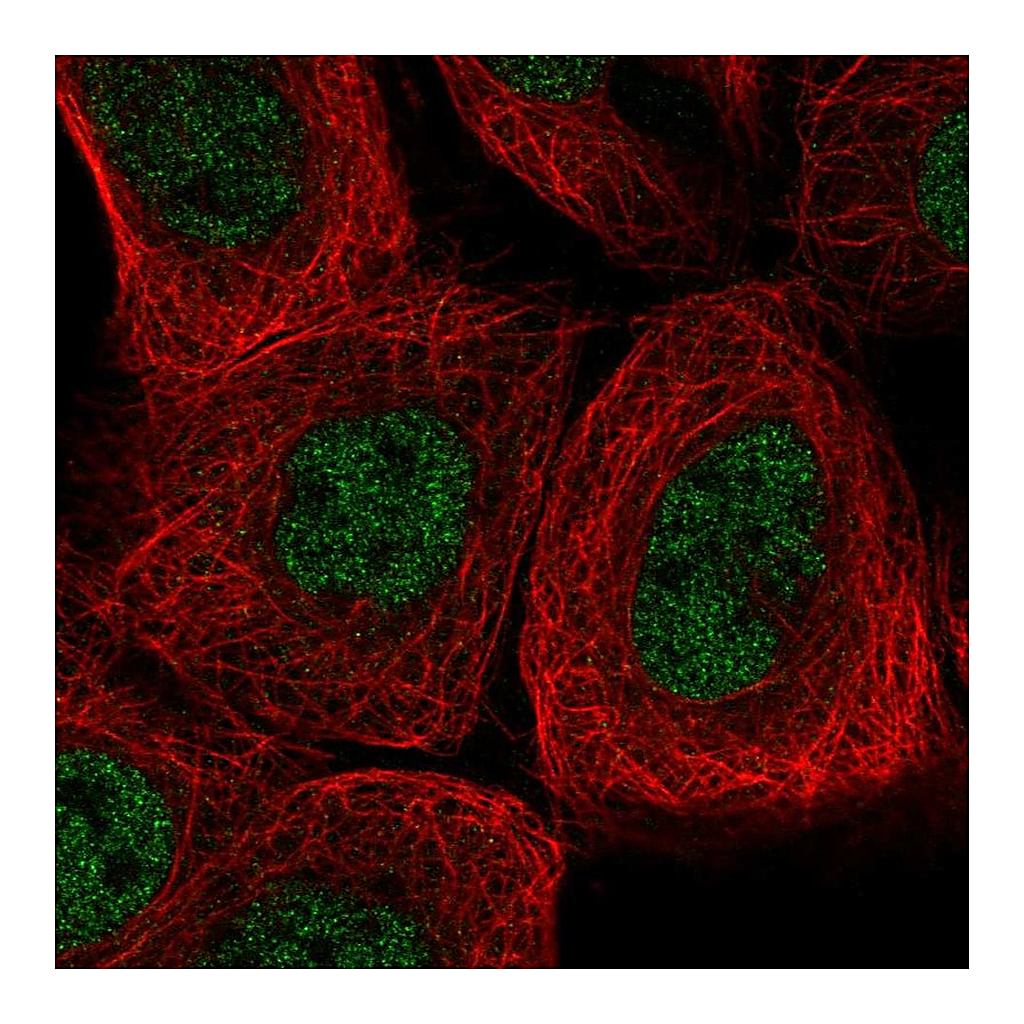Atlas Antibodies Anti-AGL Antibody