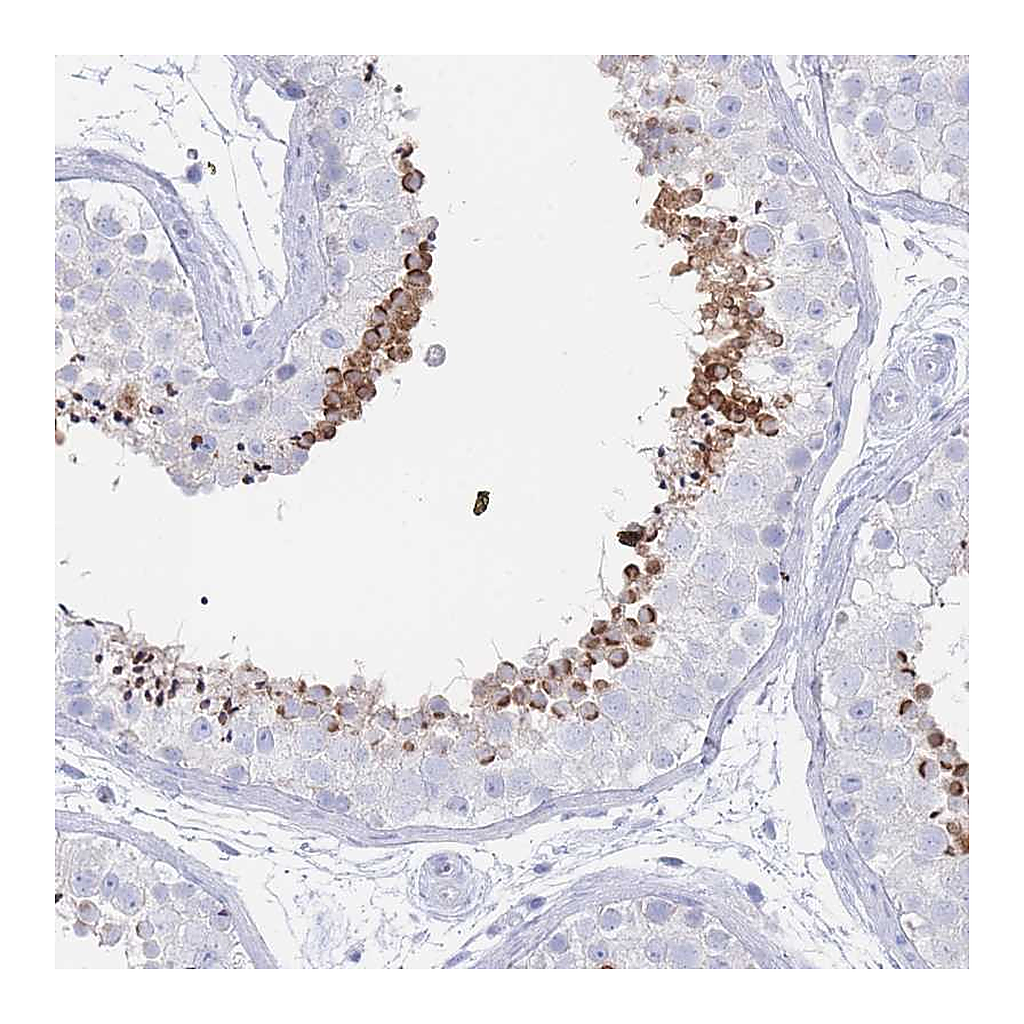Atlas Antibodies Anti-LRRC37A2 Antibody