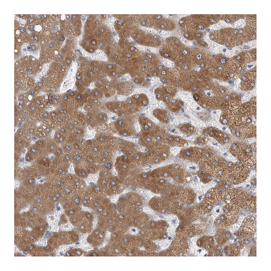 Atlas Antibodies Anti-LRRC40 Antibody