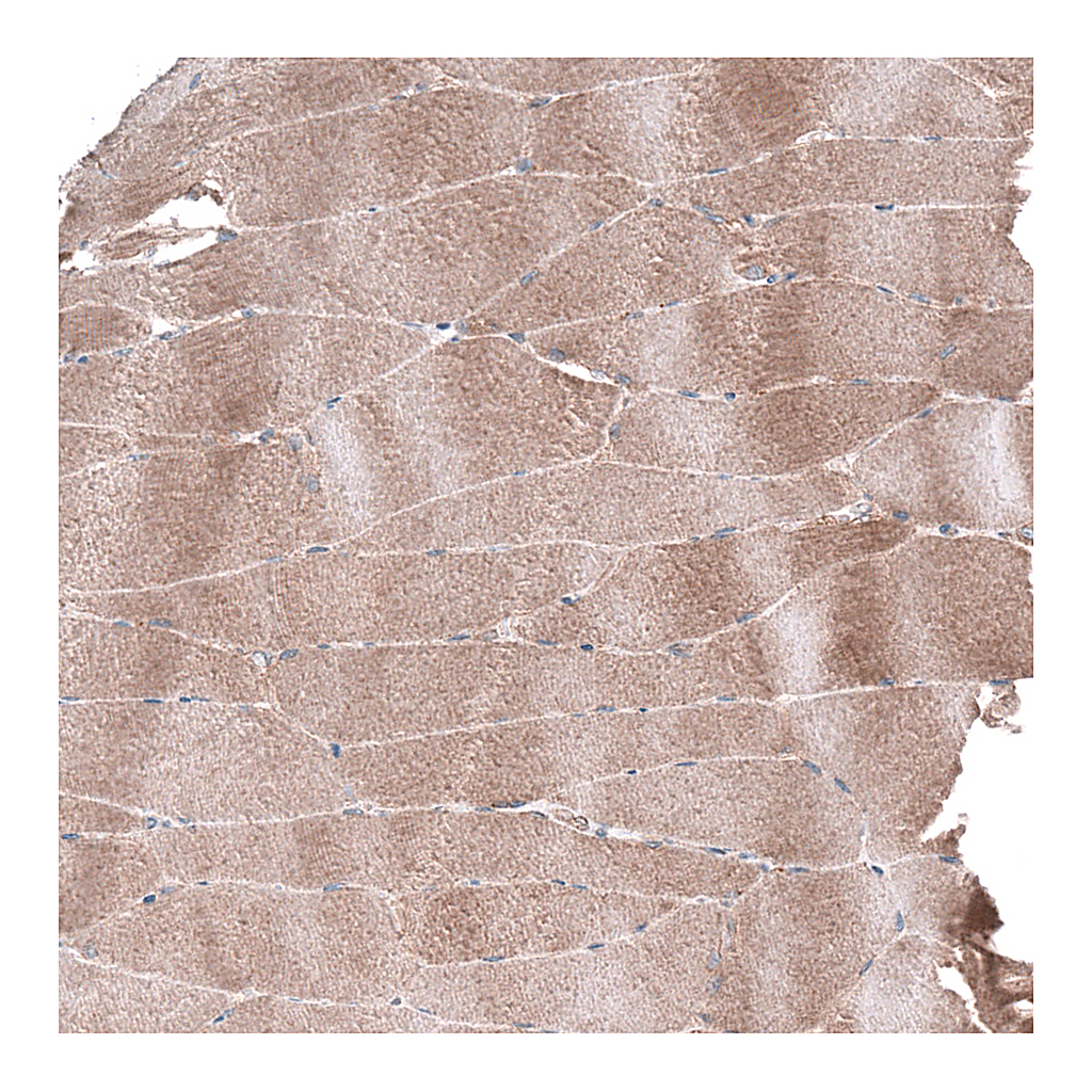 Atlas Antibodies Anti-AGL Antibody