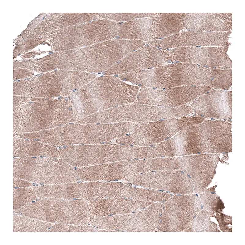 Atlas Antibodies Anti-AGL Antibody