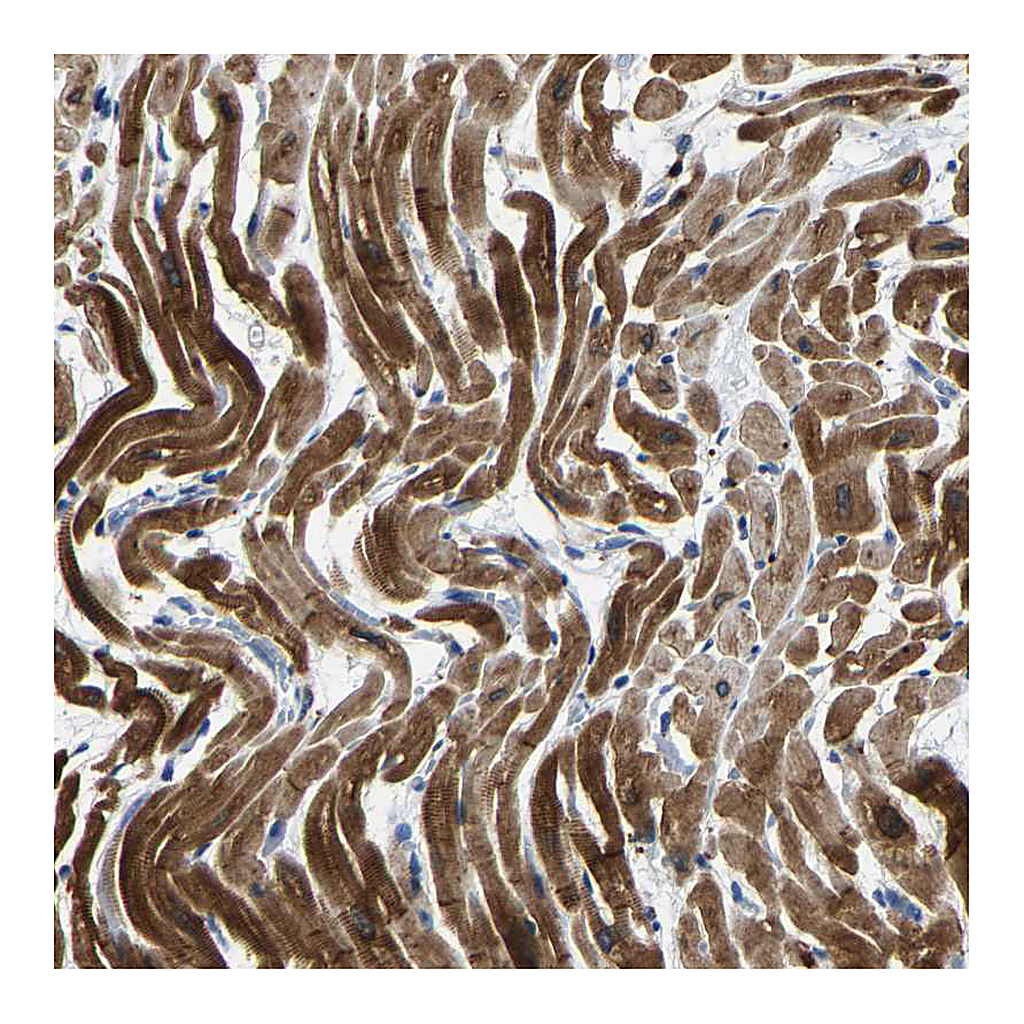 Atlas Antibodies Anti-AGK Antibody