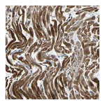 Atlas Antibodies Anti-AGK Antibody