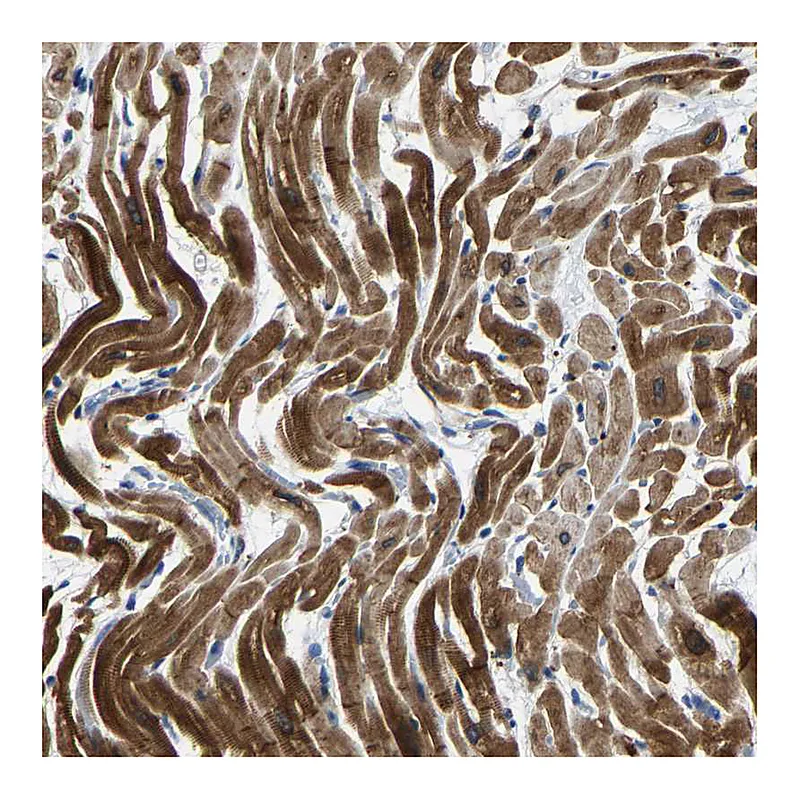 Atlas Antibodies Anti-AGK Antibody