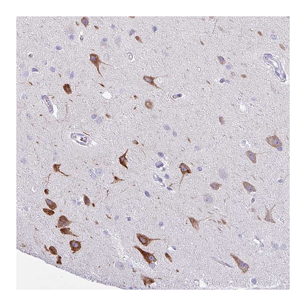 Atlas Antibodies Anti-AGO3 Antibody