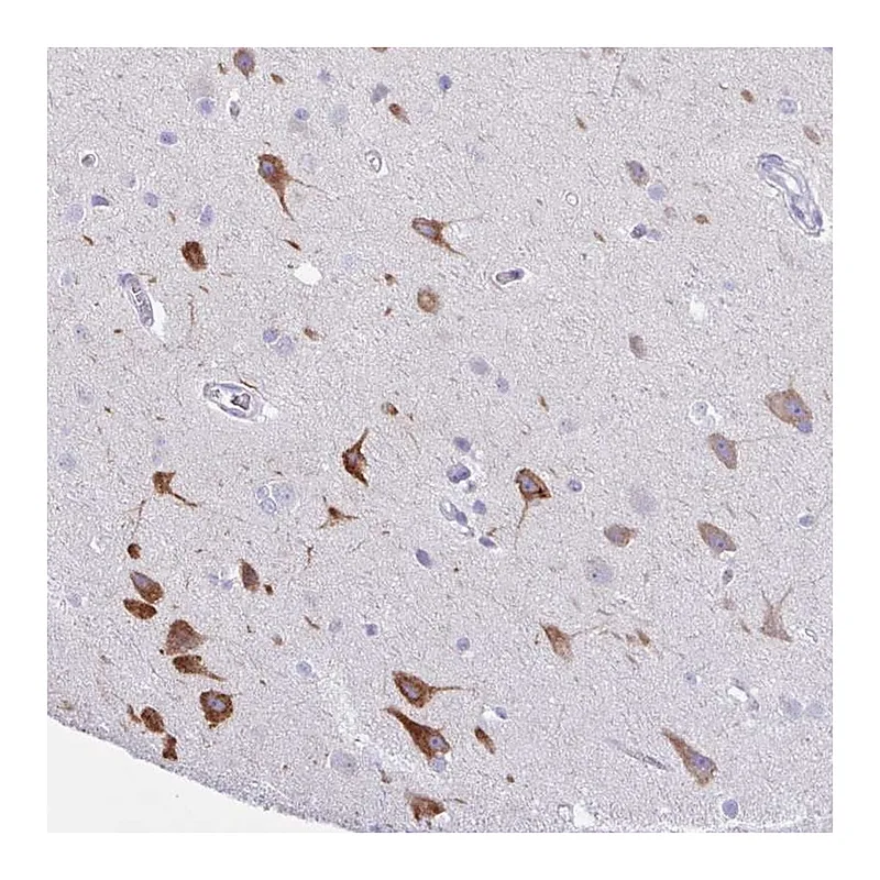 Atlas Antibodies Anti-AGO3 Antibody