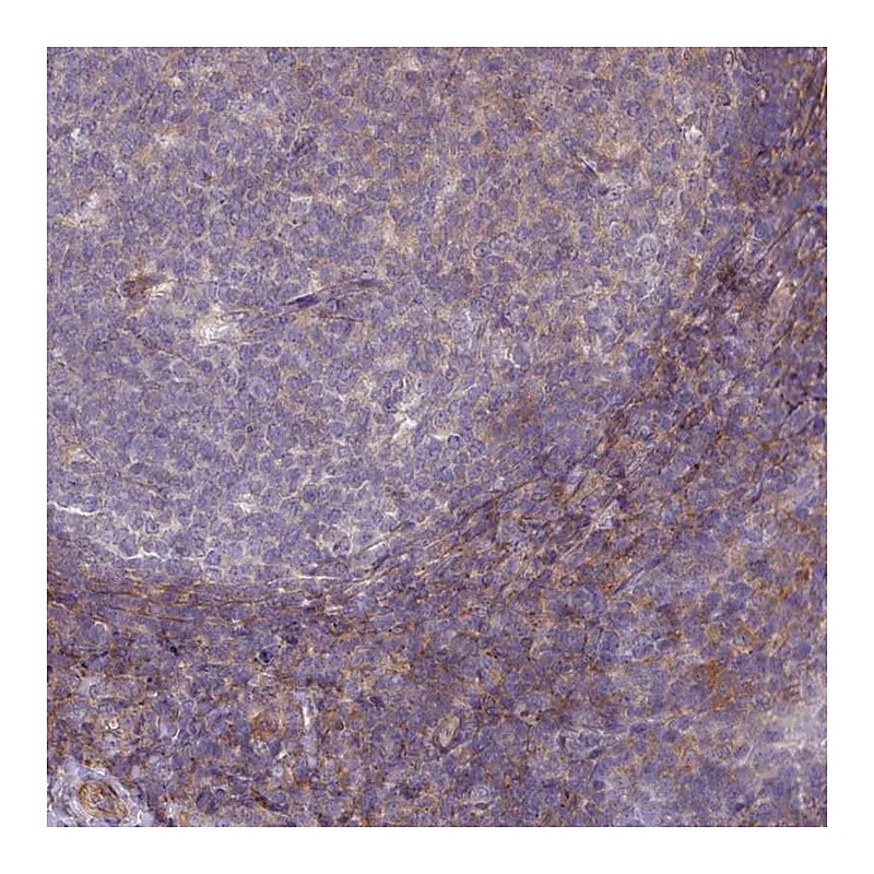 Atlas Antibodies Anti-LRRC41 Antibody